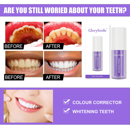 GlorySmile v34™ – Correcteur de Couleur Dentaire