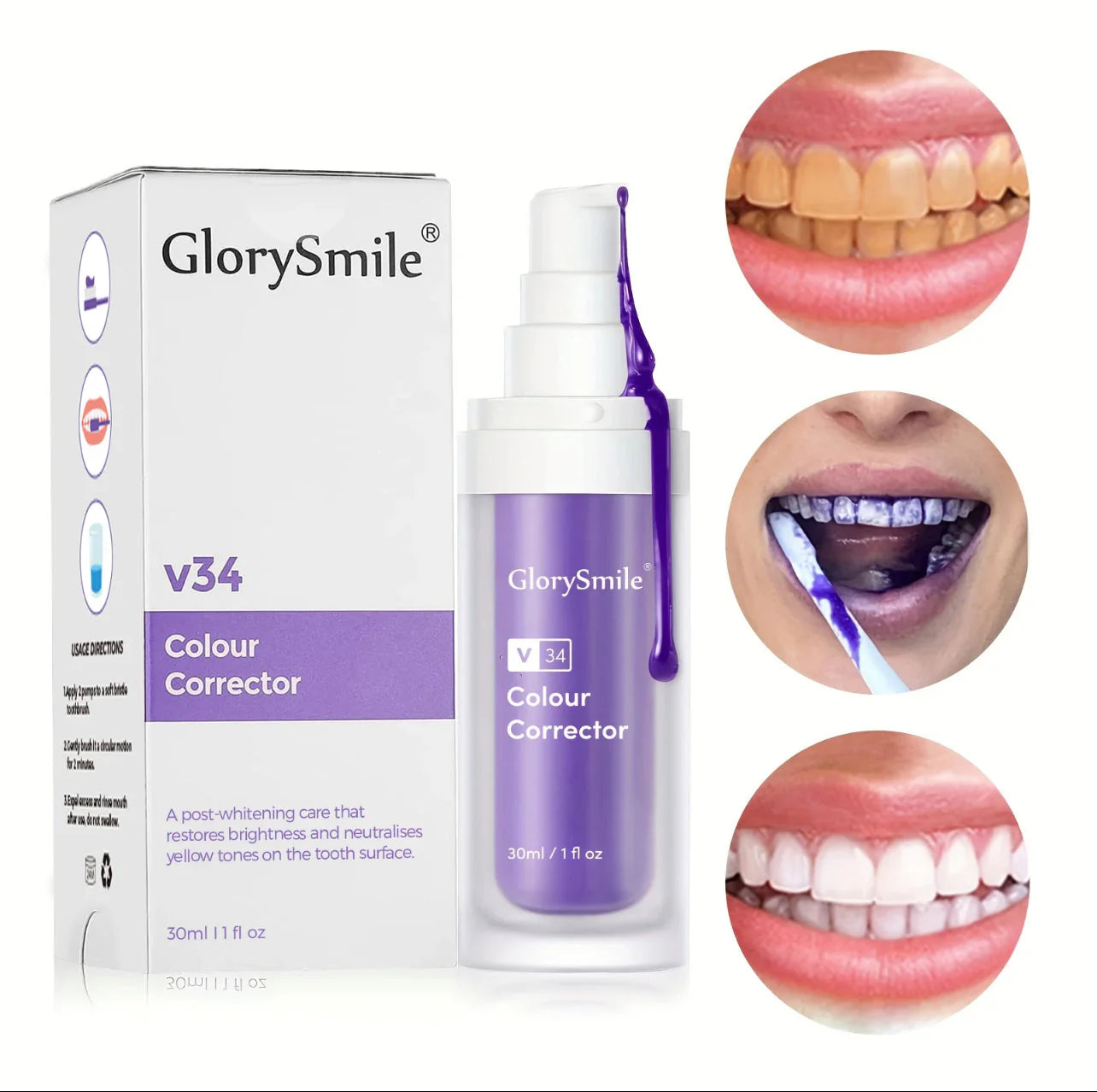 GlorySmile v34™ – Correcteur de Couleur Dentaire